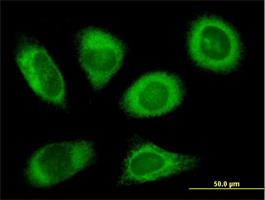 Immunocytochemistry/Immunofluorescence: Ribophorin II Antibody [H00006185-B01] - Immunofluorescence of purified MaxPab antibody to RPN2 on HeLa cell. [antibody concentration 10 ug/ml]
