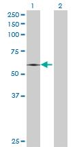 Western Blot: Ribophorin II Antibody [H00006185-B01] - analysis of RPN2 expression in transfected 293T cell line by RPN2 MaxPab polyclonal antibody (B01). Lane 1: RPN2 transfected lysate (69.30 KDa). Lane 2: Non-transfected lysate.