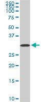 Western Blot: Aquaporin-8 Antibody (1A1) [H00000343-M01] - AQP8 monoclonal antibody (M01), clone 1A1. Western Blot analysis of AQP8 expression in PC-12(Cat # L012V1 ).
