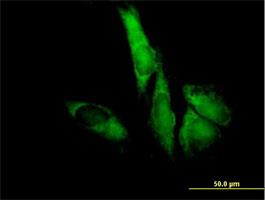 Immunocytochemistry/Immunofluorescence: EIF3F Antibody [H00008665-B02] - Immunofluorescence of purified MaxPab antibody to EIF3S5 ( Cat# H00008665-B02 ) on HeLa cell . [antibody concentration 10 ug/ml]