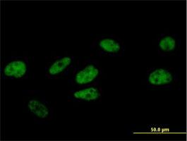 Immunocytochemistry/Immunofluorescence: FBXO34 Antibody [H00055030-B01] - Immunofluorescence of purified MaxPab antibody to FBXO34 on HeLa cell. [antibody concentration 10 ug/ml]