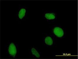 Immunocytochemistry/Immunofluorescence: VGLL1 Antibody [H00051442-B02] - Immunofluorescence of purified MaxPab antibody to VGLL1 on HeLa cell. [antibody concentration 10 ug/ml]