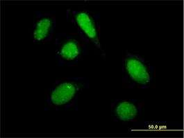 Immunocytochemistry/Immunofluorescence: PHF20L1 Antibody [H00051105-B01P] - Immunofluorescence of purified MaxPab antibody to PHF20L1 on HeLa cell. [antibody concentration 10 ug/ml]