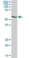 Western Blot: C17orf66 Antibody [H00256957-B01P] - C17orf66 MaxPab polyclonal antibody. Western Blot analysis of C17orf66 expression in human kidney.