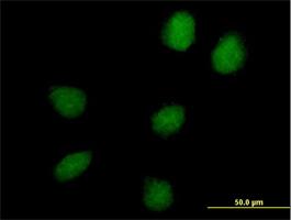 Immunocytochemistry/Immunofluorescence: C17orf66 Antibody [H00256957-B01P] - Immunofluorescence of purified MaxPab antibody to C17orf66 on HeLa cell. [antibody concentration 10 ug/ml]