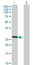 Western Blot: C17orf66 Antibody [H00256957-B01P] - analysis of C17orf66 expression in transfected 293T cell line by C17orf66 MaxPab polyclonal antibody. Lane 1: C17orf66 transfected lysate (24.09 KDa). Lane 2: Non-transfected lysate.