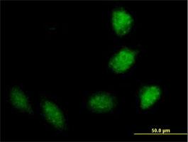 Immunocytochemistry/Immunofluorescence: TRIM40 Antibody [H00135644-B01] - Immunofluorescence of purified MaxPab antibody to TRIM40 on HeLa cell. [antibody concentration 10 ug/ml]