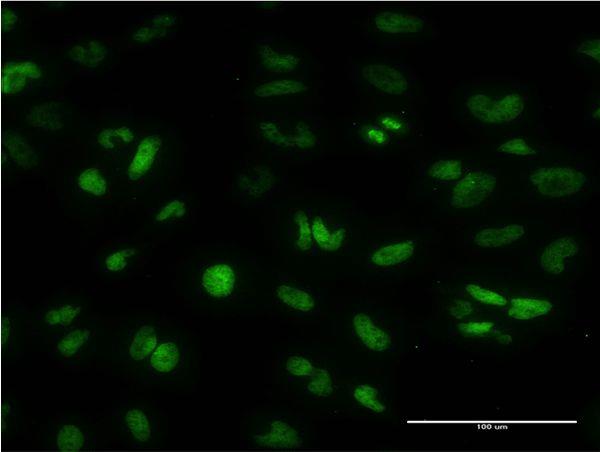 Immunocytochemistry/Immunofluorescence: ARID1A Antibody (3H14) [H00008289-M02] - on HeLa cell. Concentration: 10 ug/ml