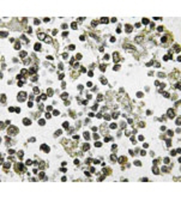 Immunohistochemistry: DDX55 Antibody [NBP1-00780] - Immunohistochemistry (IHC) analyzes of DDX55 (Q133) antibody in paraffin-embedded human lymph node tissue