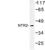 Western Blot: Neurotensin Receptor 2 Antibody [NBP1-00959] - Western blot (WB) analysis of NTR2 (D184) antibody in extracts from Jurkat cells.