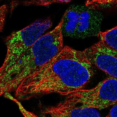 Immunocytochemistry/Immunofluorescence: LRP2 Antibody [NBP2-39033] - Immunofluorescent staining of human cell line HEK 293 shows positivity in mitochondria.