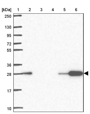 Western Blot: Synaptoporin Antibody [NBP2-38932] - Lane 1: Marker [kDa] 250, 130, 95, 72, 55, 36, 28, 17, 10<br/>Lane 2: RT-4<br/>Lane 3: U-251 MG<br/>Lane 4: Human Plasma<br/>Lane 5: Liver<br/>Lane 6: Tonsil