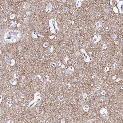 Immunohistochemistry: Synaptoporin Antibody [NBP2-38932] - Staining of human cerebral cortex shows moderate cytoplasmic  positivity in neuropil.