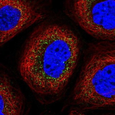 Immunocytochemistry/Immunofluorescence: Tuftelin 1 Antibody [NBP2-38723] - Immunofluorescent staining of human cell line A-431 shows positivity in vesicles.
