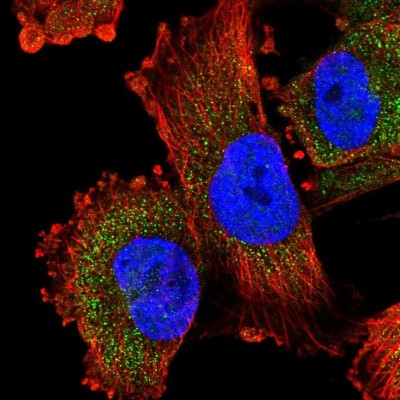 Immunocytochemistry/Immunofluorescence: KPNA5 Antibody [NBP2-38715] - Immunofluorescent staining of human cell line U-251 MG shows positivity in cytoplasm.