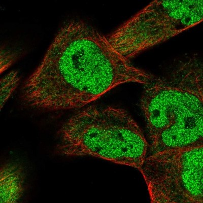 Immunocytochemistry/Immunofluorescence: Smad9 Antibody [NBP2-38176] - Immunofluorescent staining of human cell line RH-30 shows positivity in cytoplasm and nucleus but excluded from the nucleoli.