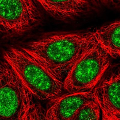 Immunocytochemistry/Immunofluorescence: TCF-3/E2A Antibody [NBP2-38611] - Immunofluorescent staining of human cell line MCF7 shows positivity in nucleus but excluded from the nucleoli.
