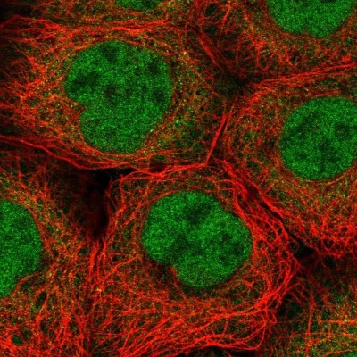 Immunocytochemistry/Immunofluorescence: BBX Antibody [NBP2-38633] - Immunofluorescent staining of human cell line A-431 shows positivity in cytoplasm and nucleus but excluded from the nucleoli.