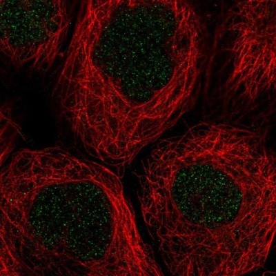 Immunocytochemistry/Immunofluorescence: CSGLCAT Antibody [NBP2-38654] - Immunofluorescent staining of human cell line A-431 shows positivity in nucleus.