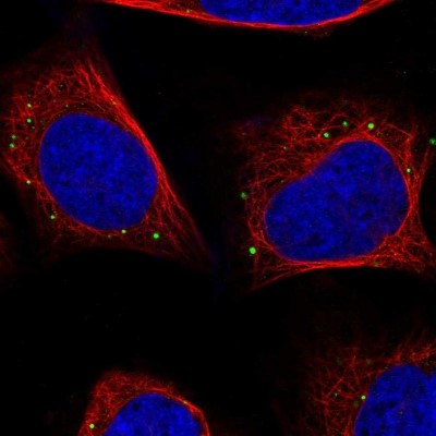 Immunocytochemistry/Immunofluorescence: JNK/JIP3 Antibody [NBP2-38490] - Immunofluorescent staining of human cell line U-2 OS shows positivity in vesicles.