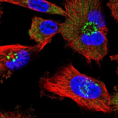 Immunocytochemistry/Immunofluorescence: alpha 1 Mannosidase 1A Antibody [NBP2-37938] - Immunofluorescent staining of human cell line U-251 MG shows positivity in cytoplasm and the Golgi apparatus.