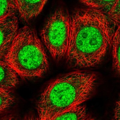 Immunocytochemistry/Immunofluorescence: ZIC4 Antibody [NBP2-37867] - Immunofluorescent staining of human cell line MCF7 shows positivity in nucleus and nucleoli.