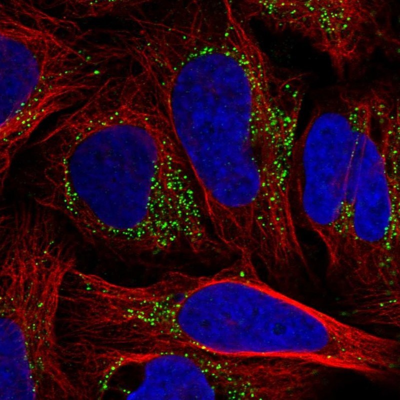 Immunocytochemistry/Immunofluorescence: Tm9sf3 Antibody [NBP1-80736] - staining of human cell line U-2 OS shows positivity in vesicles.