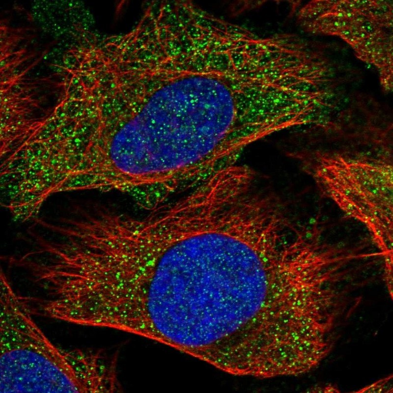 Immunocytochemistry/Immunofluorescence: DIO2 Antibody [NBP1-80770] - staining of human cell line U-2 OS shows positivity in cytoplasm.