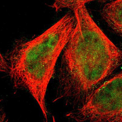 Immunocytochemistry/Immunofluorescence: PAX4 Antibody [NBP1-81043] Staining of human cell line A-431 shows positivity in nuclei but not nucleoli.