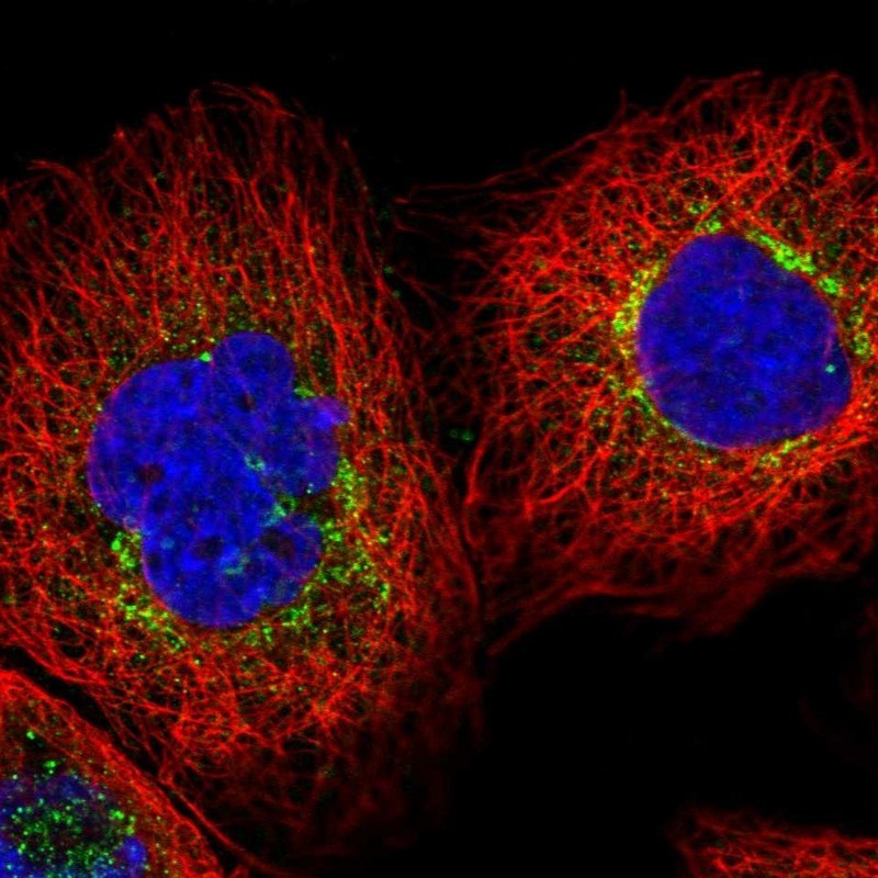 Immunocytochemistry/Immunofluorescence: GLIPR1L2 Antibody [NBP1-81091] - Staining of human cell line A-431 shows positivity in golgi apparatus.