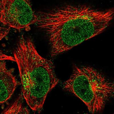 Immunocytochemistry/Immunofluorescence: SLCO4C1 Antibody [NBP1-80975] - Staining of human cell line U-251 MG shows positivity in nucleus but not nucleoli, nuclear membrane & golgi apparatus.