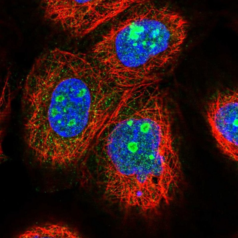 Immunocytochemistry/Immunofluorescence: EFCAB7 Antibody [NBP1-81374] - Staining of human cell line A-431 shows positivity in nucleus & nucleoli.