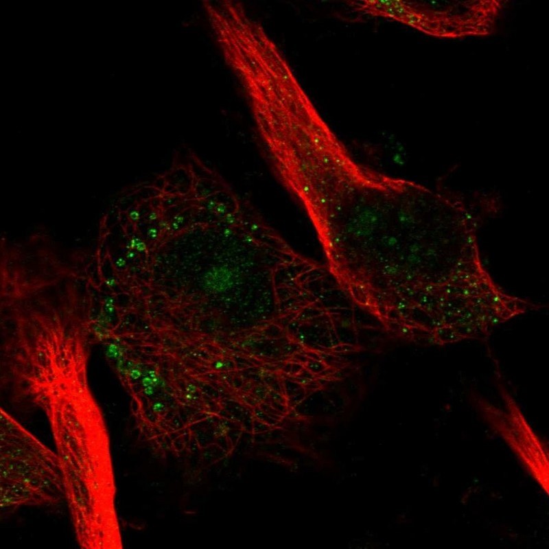 Immunocytochemistry/Immunofluorescence: RNF157 Antibody [NBP1-81361] - Staining of human cell line U-251 MG shows positivity in nucleoli & vesicles.