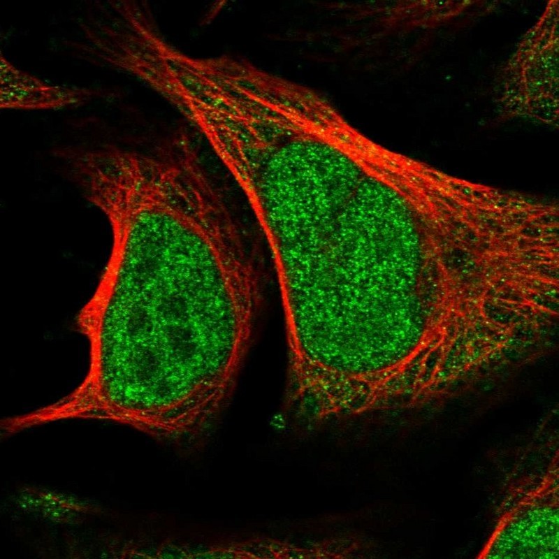 Immunocytochemistry/Immunofluorescence: LRRC10 Antibody [NBP1-81704] - Staining of human cell line U-2 OS shows positivity in nucleus but not nucleoli.