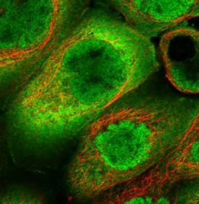 Immunocytochemistry/Immunofluorescence: DOCK2 Antibody [NBP1-83023] - Immunofluorescent staining of human cell line A-431 shows positivity in nucleus but not nucleoli, plasma membrane & cytoplasm. Antibody staining is shown in green.