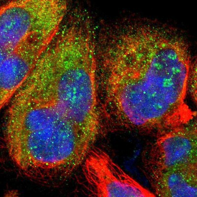 Immunocytochemistry/Immunofluorescence: ZHX3 Antibody [NBP1-83011] Staining of human cell line A-431 shows positivity in nucleoli & cytoplasm.