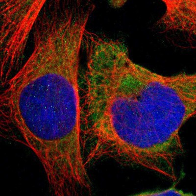 Immunocytochemistry/Immunofluorescence: HDLBP Antibody [NBP1-83287] Staining of human cell line U-2 OS shows positivity in cytoplasm.
