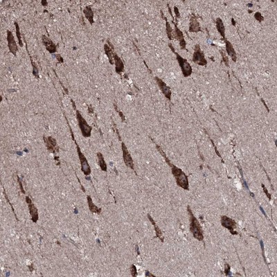 Immunohistochemistry-Paraffin: C12orf50 Antibody [NBP1-83497] - Staining of human hippocampus shows strong cytoplasmic positivity in neuronal cells.