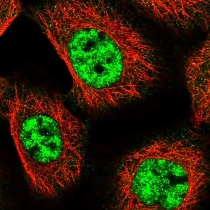 Immunocytochemistry/Immunofluorescence: MED18 Antibody [NBP1-83673] - Staining of human cell line A-431 shows positivity in nuclei but not nucleoli.