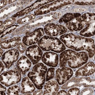 Immunohistochemistry-Paraffin: C1orf186 Antibody [NBP1-82214] - Staining of human kidney shows strong cytoplasmic positivity in renal tubules.