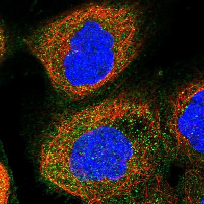Immunocytochemistry/Immunofluorescence: RP2 Antibody [NBP1-82550] Staining of human cell line A-431 shows positivity in plasma membrane & cytoplasm.