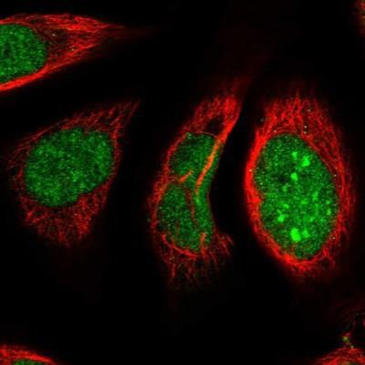 Immunocytochemistry/Immunofluorescence: NUFIP1 Antibody [NBP1-82514] - Staining of human cell line U-2 OS shows positivity in nucleus & nucleoli.