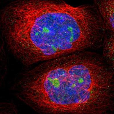 Immunocytochemistry/Immunofluorescence: WHSC1 Antibody [NBP1-82632] - Staining of human cell line A-431 shows positivity in nucleus, nucleoli & nuclear membrane.