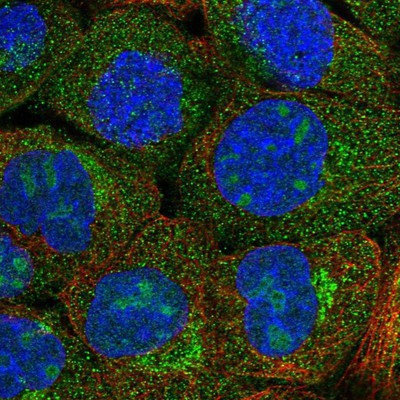 Immunocytochemistry/Immunofluorescence: EFCAB4B Antibody [NBP1-82687] Staining of human cell line A-431 shows positivity in nucleus, nucleoli, cytoplasm & golgi apparatus.