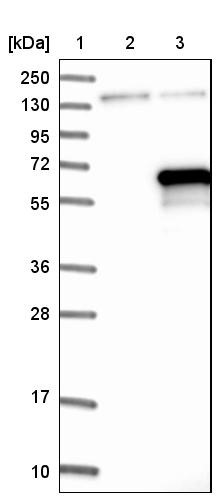 Western Blot: C9orf43 Antibody [NBP1-82742] - Lane 1: Marker [kDa] 250, 130, 95, 72, 55, 36, 28, 17, 10<br/>Lane 2: Negative control (vector only transfected HEK293T lysate)<br/>Lane 3: Over-expression lysate (Co-expressed with a C-terminal myc-DDK tag (~3.1 kDa) in mammalian HEK293T cells, LY407278)