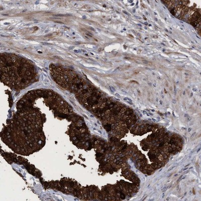 Immunohistochemistry-Paraffin: C9orf43 Antibody [NBP1-82742] - Staining of human prostate shows strong cytoplasmic positivity in glandular cells.