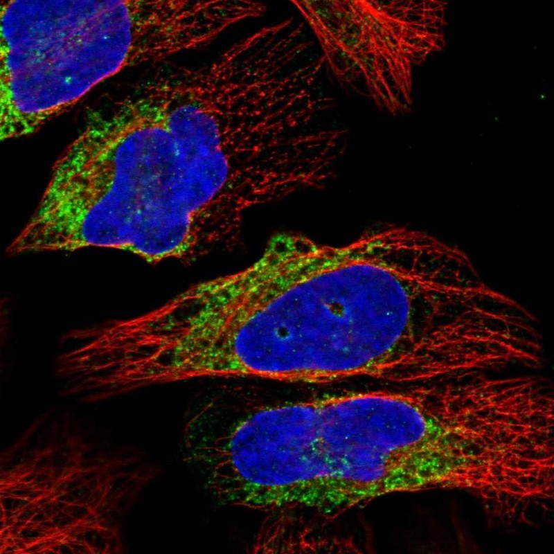 Immunocytochemistry/Immunofluorescence: ADAMDEC1 Antibody [NBP1-82809] - Staining of human cell line U-2 OS shows positivity in endoplasmic reticulum.