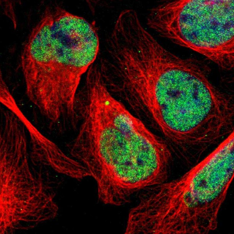 Immunocytochemistry/Immunofluorescence: KIAA0319L Antibody [NBP1-82889] - Staining of human cell line U-2 OS shows positivity in nuclei but not nucleoli.