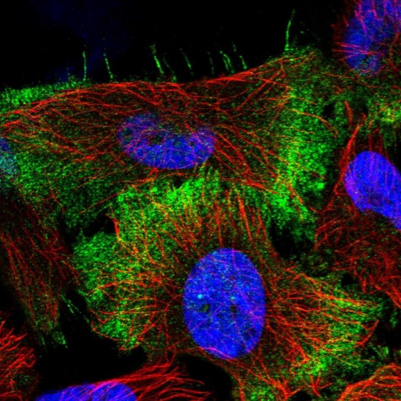 Immunocytochemistry/Immunofluorescence: LMTK3 Antibody [NBP1-82887] - Staining of human cell line U-251 MG shows positivity in nucleus but not nucleoli & plasma membrane.