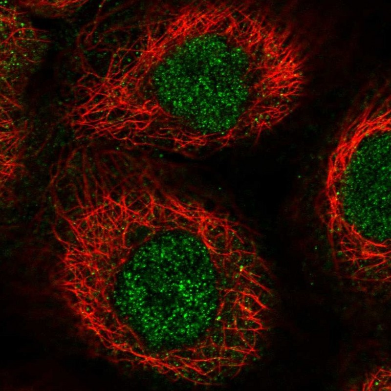 Immunocytochemistry/Immunofluorescence: RHPN1 Antibody [NBP1-82881] - Staining of human cell line A-431 shows positivity in nucleus but not nucleoli.